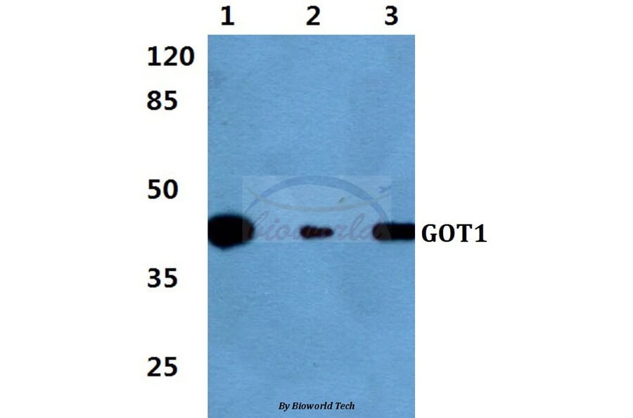 Anti-GOT1 Antibody from Bioworld Technology (BS60399) - Antibodies.com