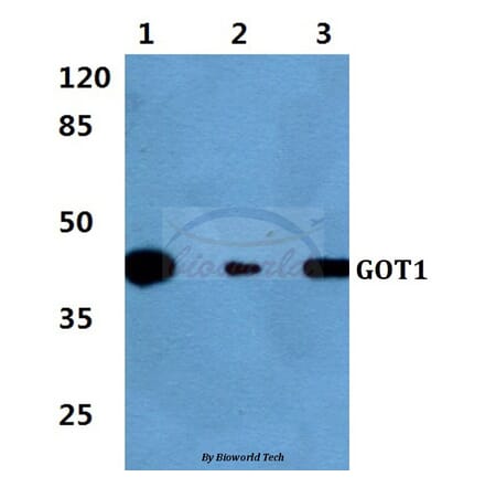 Anti-GOT1 Antibody from Bioworld Technology (BS60399) - Antibodies.com
