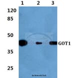 Anti-GOT1 Antibody from Bioworld Technology (BS60399) - Antibodies.com