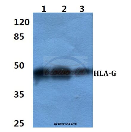 Anti-HLA-G Antibody from Bioworld Technology (BS60401) - Antibodies.com