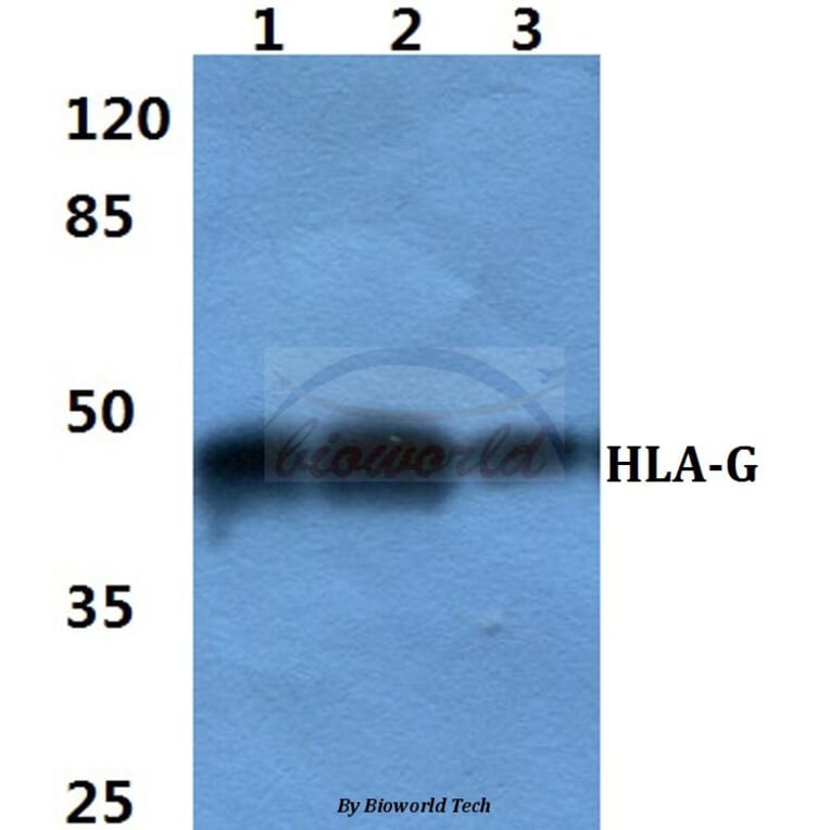 Anti-HLA-G Antibody from Bioworld Technology (BS60401) - Antibodies.com