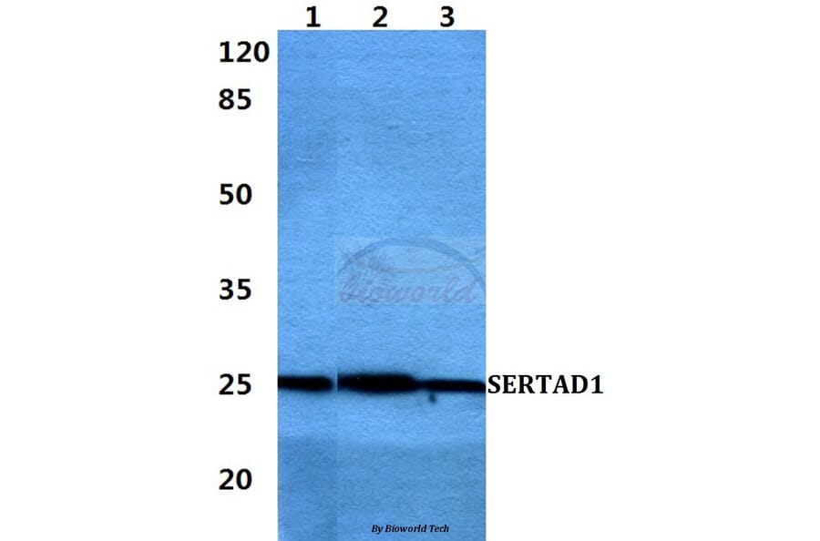 Anti-SERTAD1 Antibody from Bioworld Technology (BS60410) - Antibodies.com
