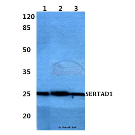 Anti-SERTAD1 Antibody from Bioworld Technology (BS60410) - Antibodies.com