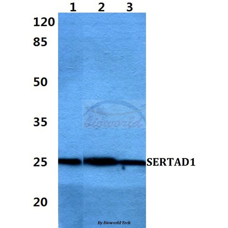 Anti-SERTAD1 Antibody from Bioworld Technology (BS60410) - Antibodies.com