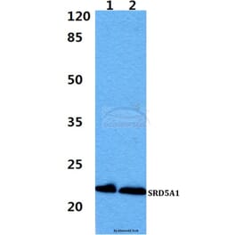 Anti-SRD5A1 Antibody from Bioworld Technology (BS60411) - Antibodies.com