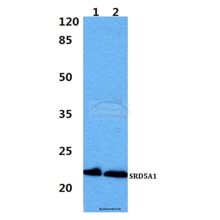 Anti-SRD5A1 Antibody from Bioworld Technology (BS60411) - Antibodies.com