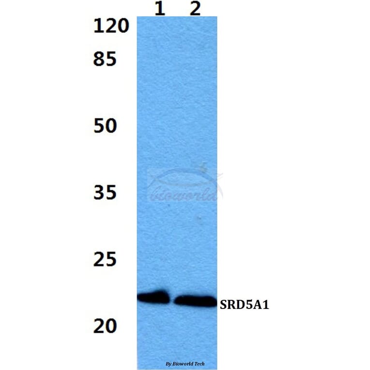 Anti-SRD5A1 Antibody from Bioworld Technology (BS60411) - Antibodies.com