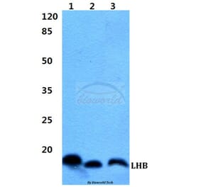 Anti-LHB Antibody from Bioworld Technology (BS60414) - Antibodies.com