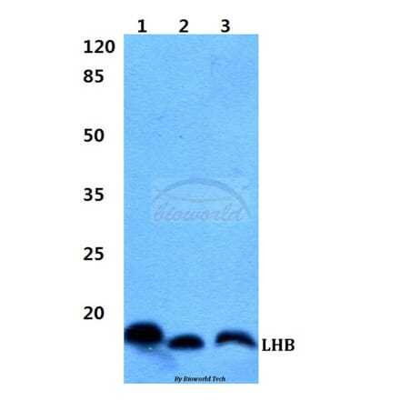 Anti-LHB Antibody from Bioworld Technology (BS60414) - Antibodies.com