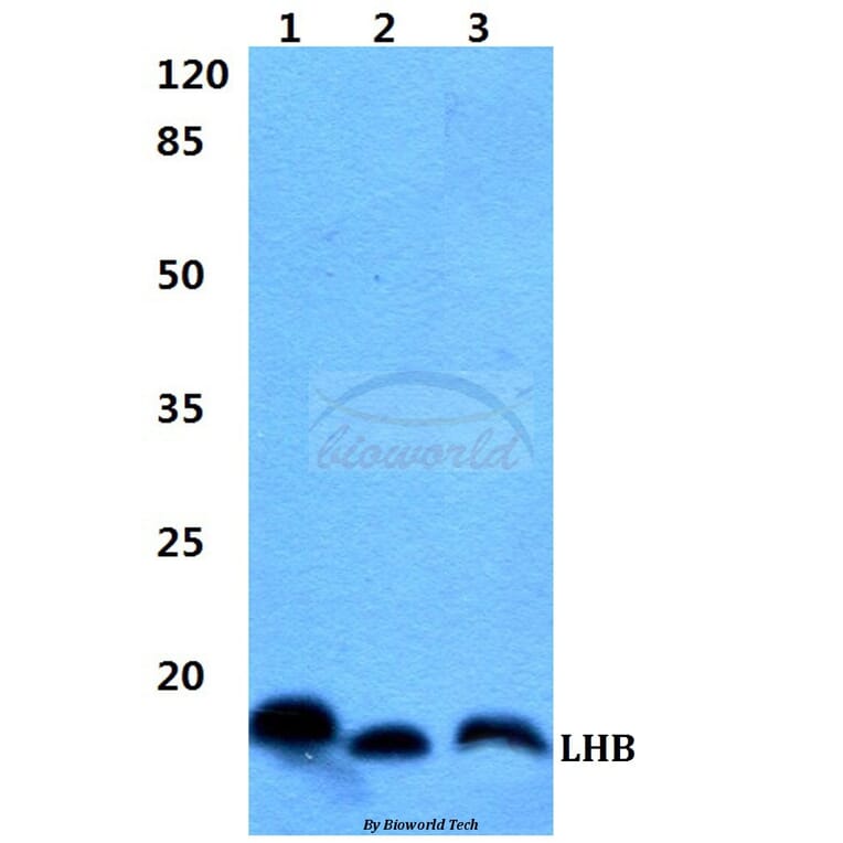 Anti-LHB Antibody from Bioworld Technology (BS60414) - Antibodies.com