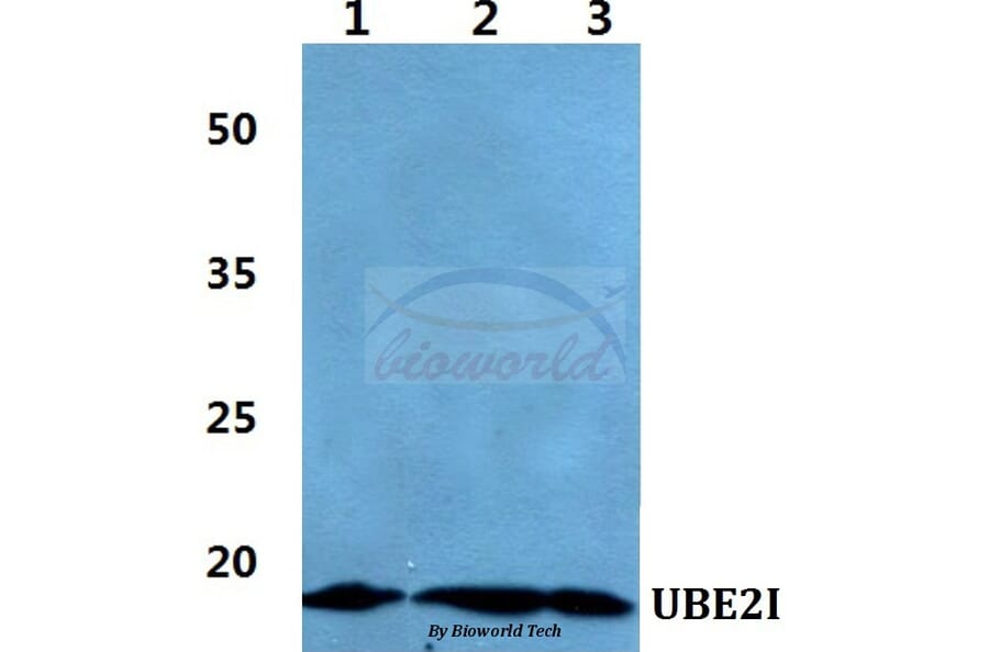 Anti-UBE2I Antibody from Bioworld Technology (BS60416) - Antibodies.com