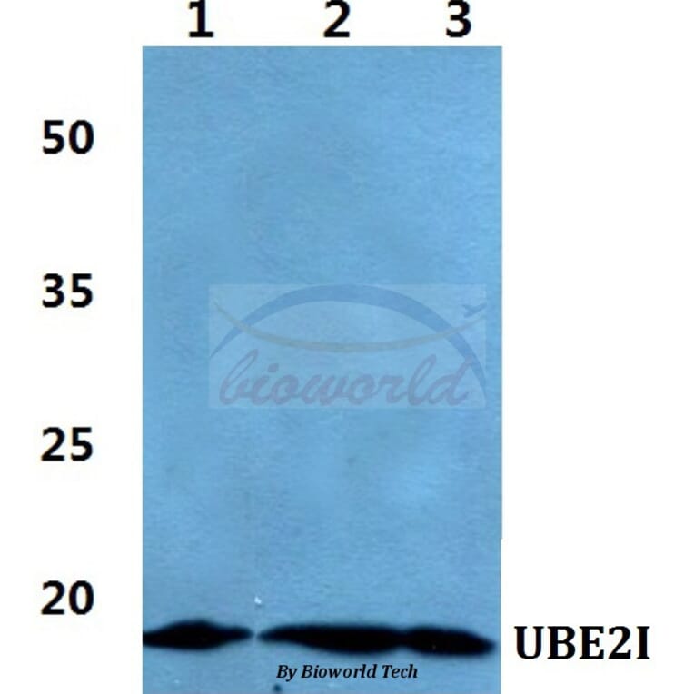 Anti-UBE2I Antibody from Bioworld Technology (BS60416) - Antibodies.com