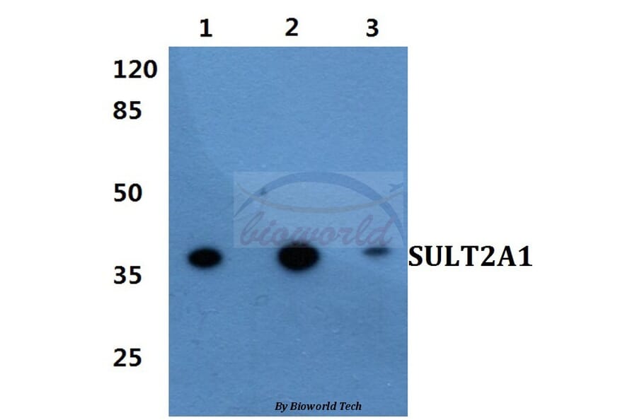 Anti-SULT2A1 Antibody from Bioworld Technology (BS60417) - Antibodies.com
