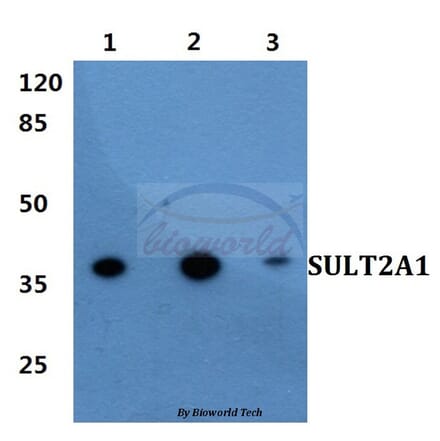 Anti-SULT2A1 Antibody from Bioworld Technology (BS60417) - Antibodies.com