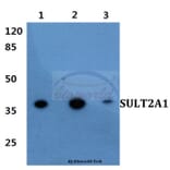 Anti-SULT2A1 Antibody from Bioworld Technology (BS60417) - Antibodies.com