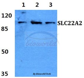 Anti-SLC22A2 Antibody from Bioworld Technology (BS60420) - Antibodies.com