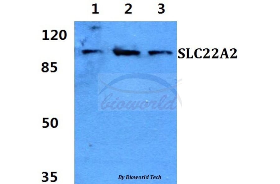 Anti-SLC22A2 Antibody from Bioworld Technology (BS60420) - Antibodies.com