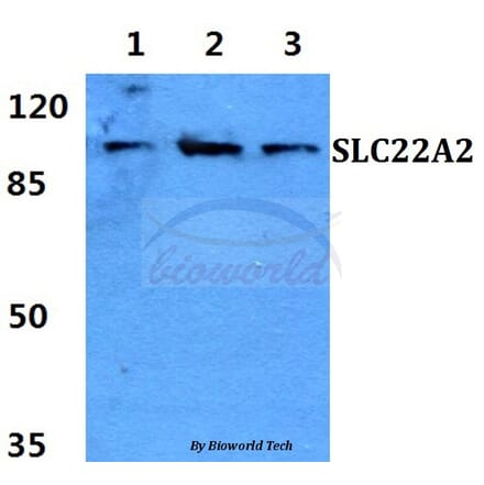 Anti-SLC22A2 Antibody from Bioworld Technology (BS60420) - Antibodies.com