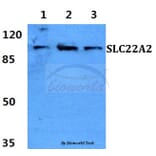 Anti-SLC22A2 Antibody from Bioworld Technology (BS60420) - Antibodies.com