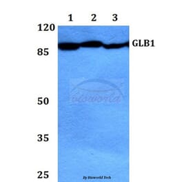 Anti-GLB1 Antibody from Bioworld Technology (BS60421) - Antibodies.com