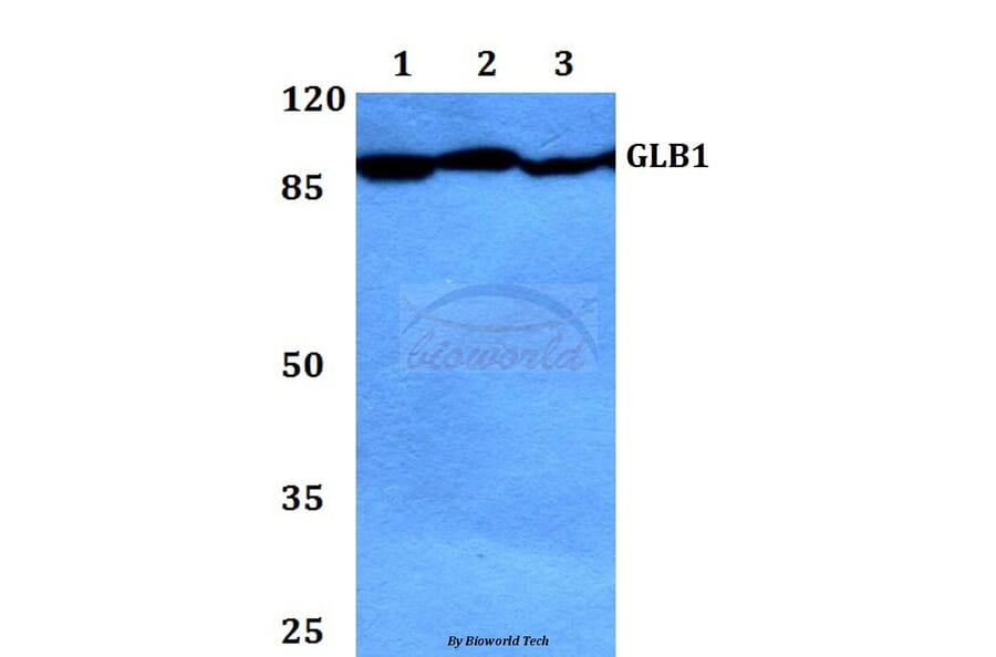Anti-GLB1 Antibody from Bioworld Technology (BS60421) - Antibodies.com