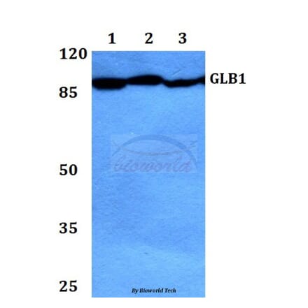 Anti-GLB1 Antibody from Bioworld Technology (BS60421) - Antibodies.com