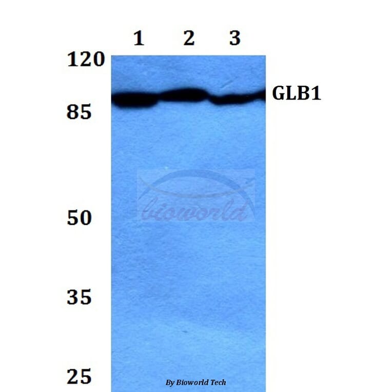 Anti-GLB1 Antibody from Bioworld Technology (BS60421) - Antibodies.com