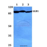 Anti-GLB1 Antibody from Bioworld Technology (BS60421) - Antibodies.com