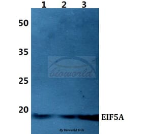 Anti-EIF5A Antibody from Bioworld Technology (BS60424) - Antibodies.com