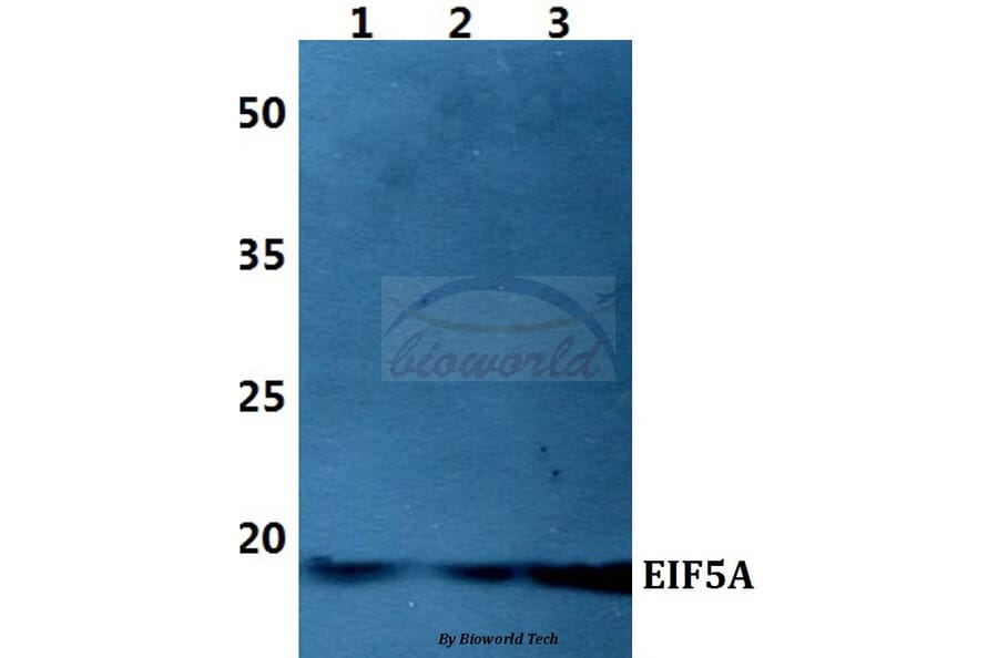 Anti-EIF5A Antibody from Bioworld Technology (BS60424) - Antibodies.com