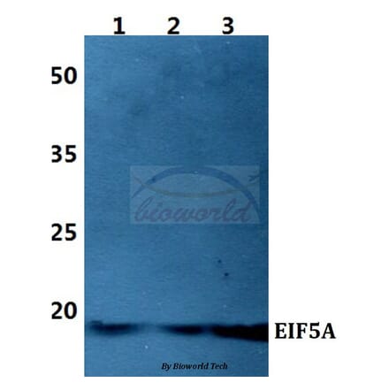 Anti-EIF5A Antibody from Bioworld Technology (BS60424) - Antibodies.com