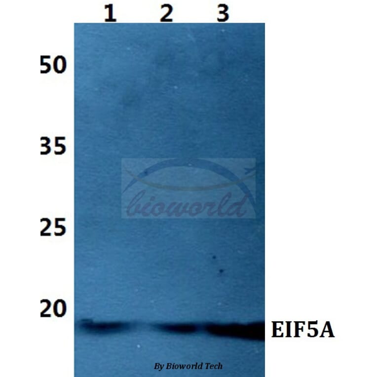 Anti-EIF5A Antibody from Bioworld Technology (BS60424) - Antibodies.com