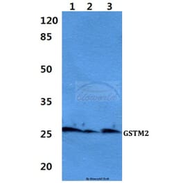 Anti-GSTM2 Antibody from Bioworld Technology (BS60429) - Antibodies.com
