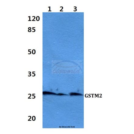 Anti-GSTM2 Antibody from Bioworld Technology (BS60429) - Antibodies.com