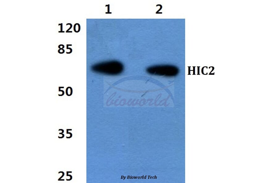 Anti-HIC2 Antibody from Bioworld Technology (BS60430) - Antibodies.com