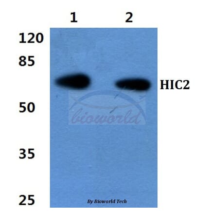 Anti-HIC2 Antibody from Bioworld Technology (BS60430) - Antibodies.com