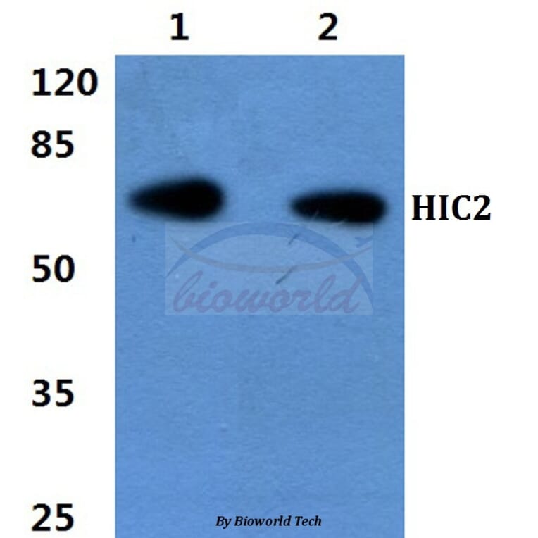 Anti-HIC2 Antibody from Bioworld Technology (BS60430) - Antibodies.com