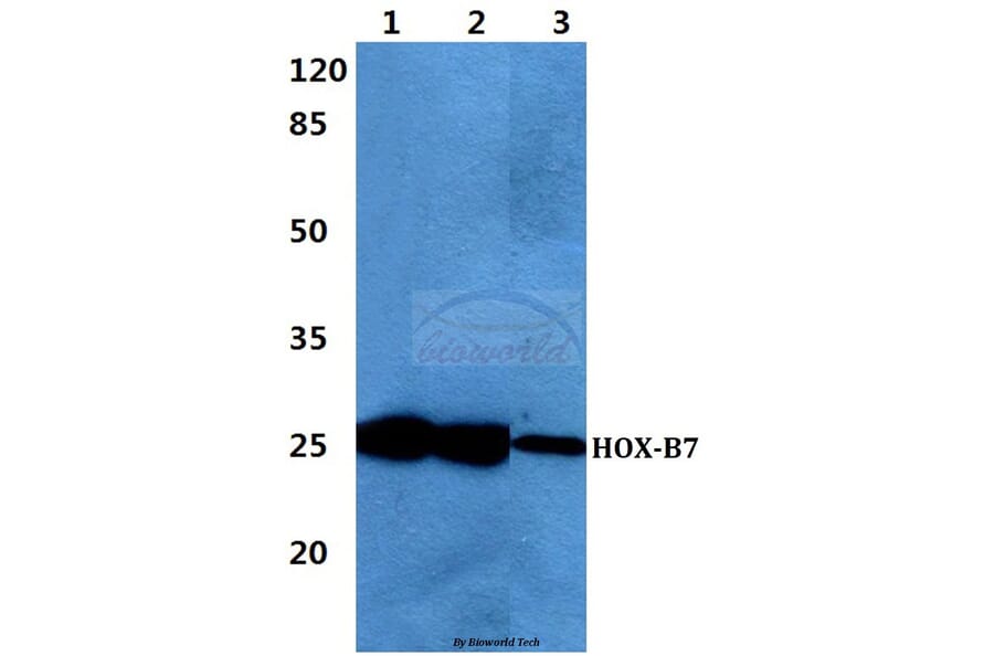 Anti-HOX-B7 Antibody from Bioworld Technology (BS60431) - Antibodies.com