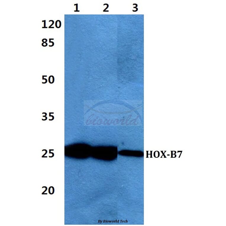 Anti-HOX-B7 Antibody from Bioworld Technology (BS60431) - Antibodies.com