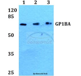 Anti-GP1BA Antibody from Bioworld Technology (BS60436) - Antibodies.com
