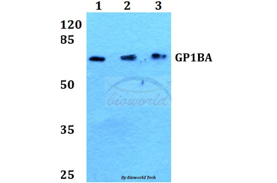 Anti-GP1BA Antibody from Bioworld Technology (BS60436) - Antibodies.com