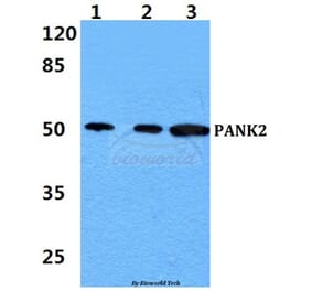 Anti-PANK2 Antibody from Bioworld Technology (BS60437) - Antibodies.com
