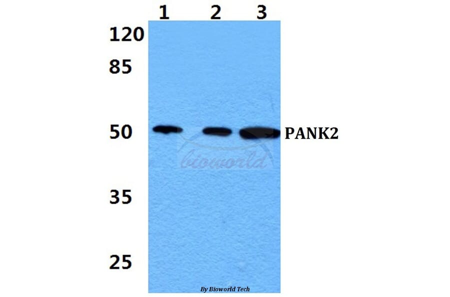 Anti-PANK2 Antibody from Bioworld Technology (BS60437) - Antibodies.com