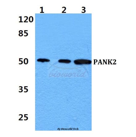 Anti-PANK2 Antibody from Bioworld Technology (BS60437) - Antibodies.com