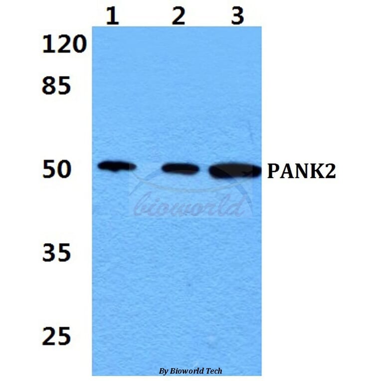 Anti-PANK2 Antibody from Bioworld Technology (BS60437) - Antibodies.com