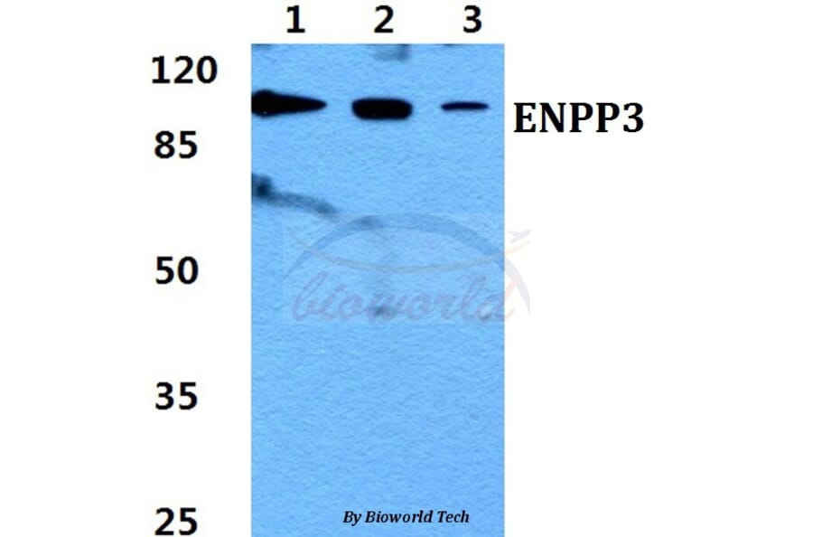 Anti-ENPP3 Antibody from Bioworld Technology (BS60438) - Antibodies.com
