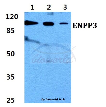 Anti-ENPP3 Antibody from Bioworld Technology (BS60438) - Antibodies.com