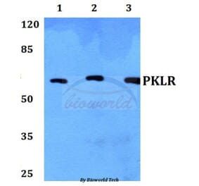 Anti-PKLR Antibody from Bioworld Technology (BS60443) - Antibodies.com