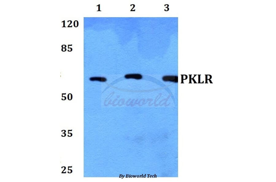 Anti-PKLR Antibody from Bioworld Technology (BS60443) - Antibodies.com