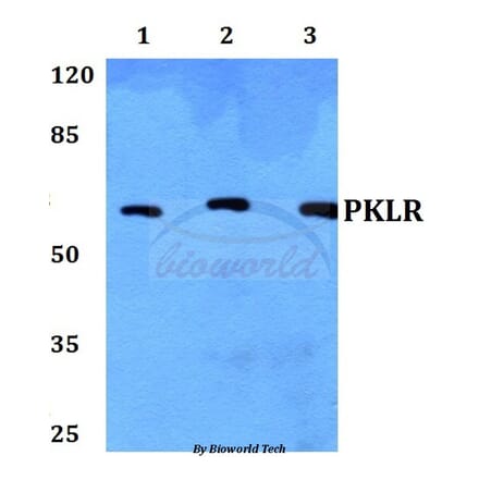 Anti-PKLR Antibody from Bioworld Technology (BS60443) - Antibodies.com